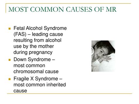 Mental Retardation Causes Risk Factors And Treatment Caepv