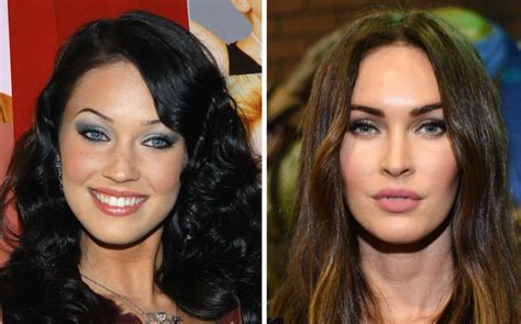 Celebrities Before And After Cosmetic Procedures