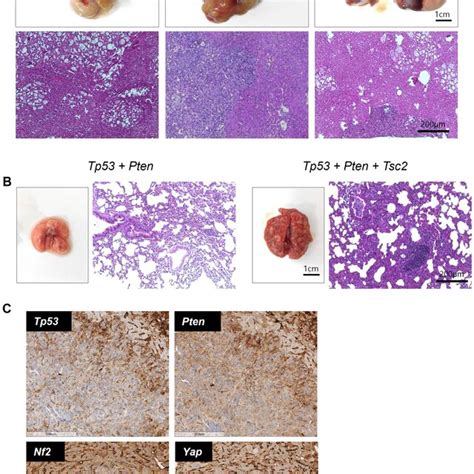 Representative Images Of Tumors With Different Gene Mutations A