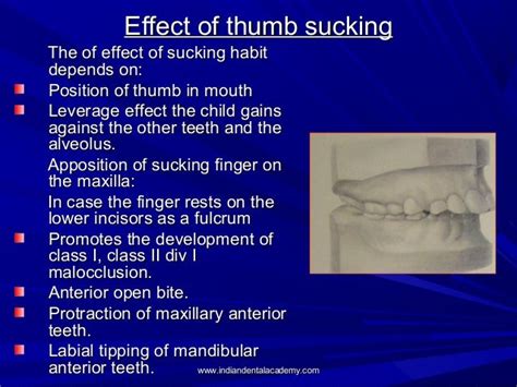 Habits And Its Management Thumb Sucking 1 Certified Fixed Orthodonti