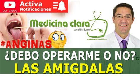 Anginas ó AmÍgdalas Operación De Anginas 👎👍 ¿sÍ O No Amigdalitis