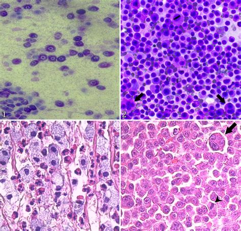 Photomicrography Of Mast Cell Tumors Skin Dog 1 Low Grade Mast