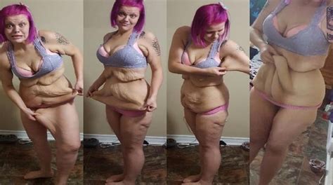 Even After Losing An Incredible 185 Pounds This Woman Is Not Happy In