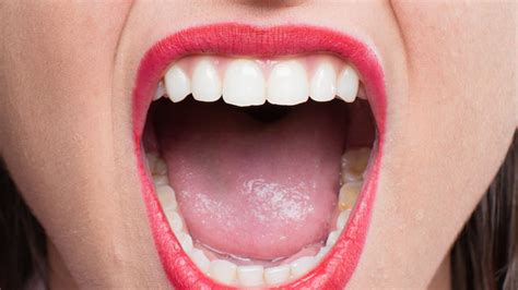 What Excessive Saliva Production Means For Oral Cavity Onlymyhealth