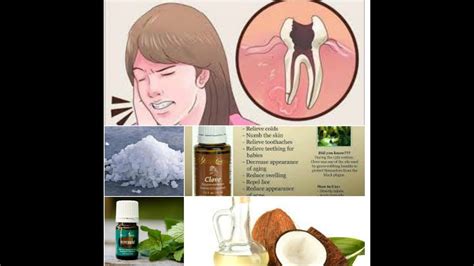 Incredible Instant Natural Home Treatments For Toothache Youtube