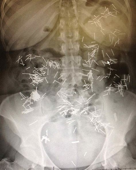 31 Funny X Ray Images That Seem Too Ridiculous To Be Real
