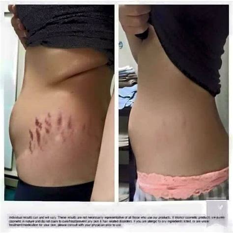 Oh My Goodness‼‼‼‼ This Picture Is From One Of Our It Works Loyal