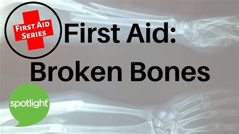 First Aid Broken Bones Practice English With Spotlight Youtube