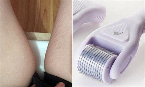 A Year Old Woman Has Revealed How A Derma Roller Kit She Bought