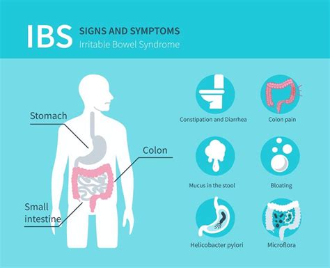 What Is The Symptoms Of Ibs Syndrome Healthy Gut Club