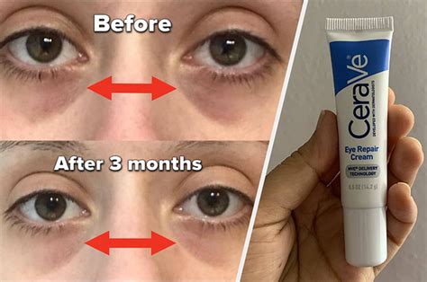 Best Eye Cream Cheap Online Discount Save 58 Jlcatjgobmx
