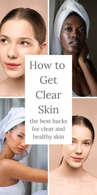 How To Get Clear Skin In 2020 Clear Skin Skin Good Skin