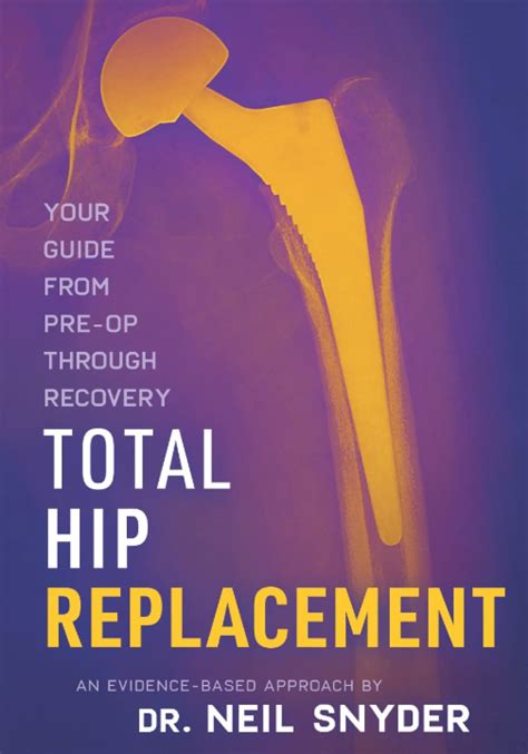Total Hip Replacement An Evidence Based Approach Your Guide From Pre