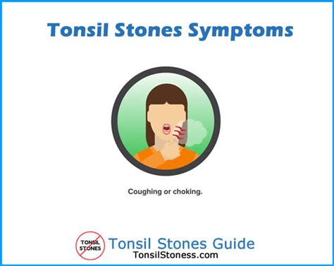 Tonsil Stones Removal Guide 2020