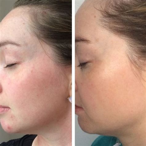 Lash Lift Eyebrow Wax Skin Deep Beauty Therapy
