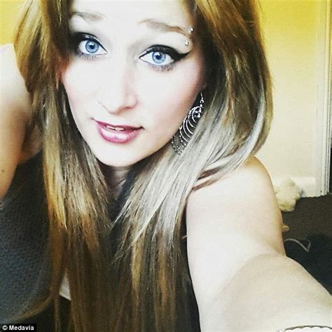 ashleigh lovric has deformed breasts after turning into a human fireball daily mail online