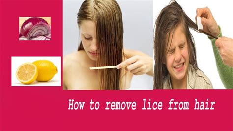 How To Remove Lice From Hair Home Remedies To Remove Lice Youtube
