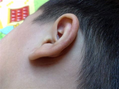 Gordons Bruised Left Ear Flickr Photo Sharing