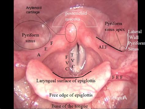 Figure From Hypopharynx And Larynx Anatomy Semantic Scholar