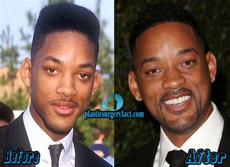 Will Smith Plastic Surgery Before After Pictures