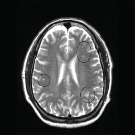 Mri Image Of The Brain In An Axial View Showing The “ Open I