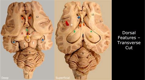 Aandp Dorsal Brain Transverse Cut Diagram Quizlet