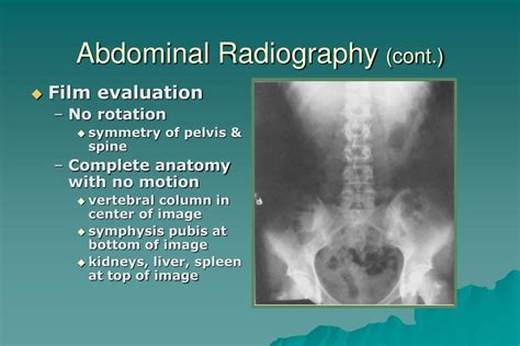 Ppt Introduction To Clinical Radiography Powerpoint Presentation