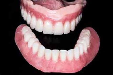A Upper And Lower Immediate Complete Dentures Download Scientific