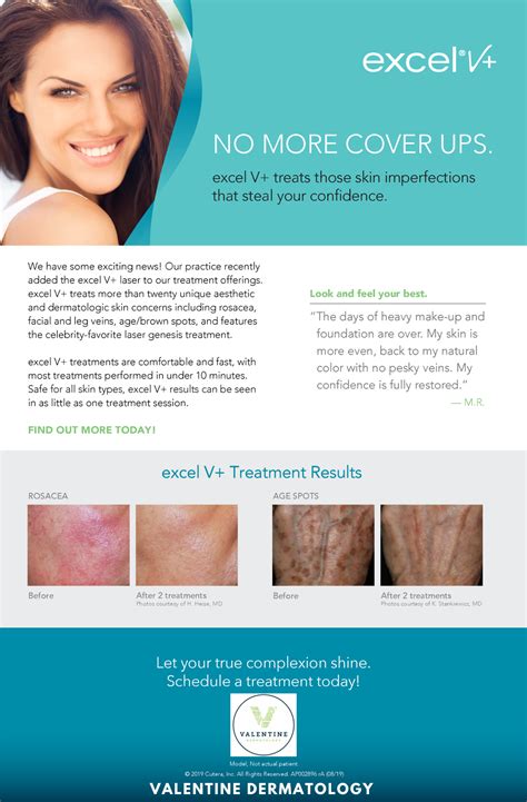 Cutera Excel V Laser And Laser Genesis Valentine Dermatology