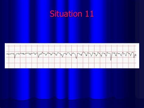 Simple Errorsin Ecg