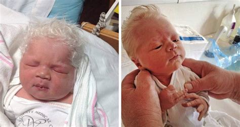 This Adorable Baby Born With Gray Hair Is Taking Over The Internet