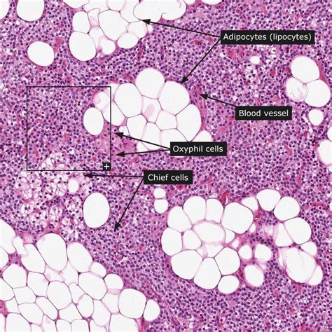 Dictionary Normal Parathyroid Gland Histology Slides Human