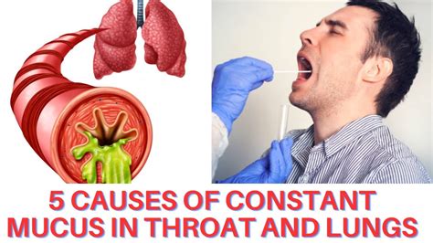 5 Causes Of Constant Mucus In Throat And Lungs Youtube