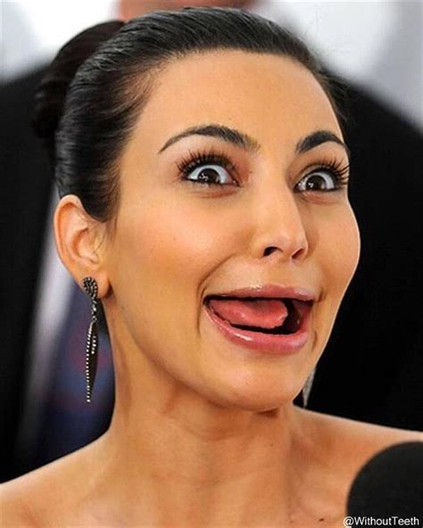 23 Lol Pictures Of Celebrities Without Teeth That Will