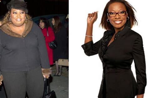 Checkout The Celebrities Who Have Had Gastric Sleeve Surgery Or Other