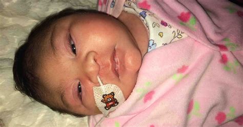 Warrior Baby Girl Born With Brain Outside Skull Fights To Survive