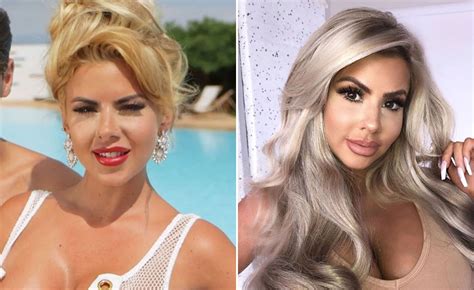 Love Island 2020 Cast Before And After Surgery Smithcoreview