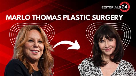 Is It True That The Actress Marlo Thomas Had Plastic Surgery?
