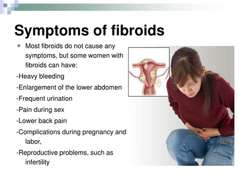 Ppt Uterinefemoral Fibroid Embolization Powerpoint Presentation