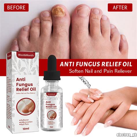 West And Month Nails Care Repair Nail Fungal Treatment Anti Fungus