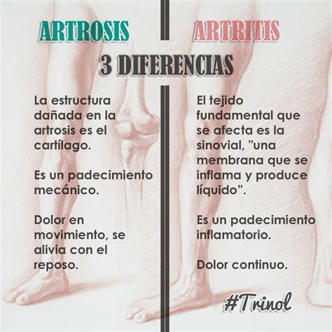 Las Grandes Diferencias Entre La Artritis Y La Artros Vrogue Co