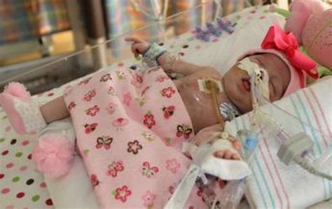 Baby Born With Heart Outside Her Body Is Recovering After Surgery