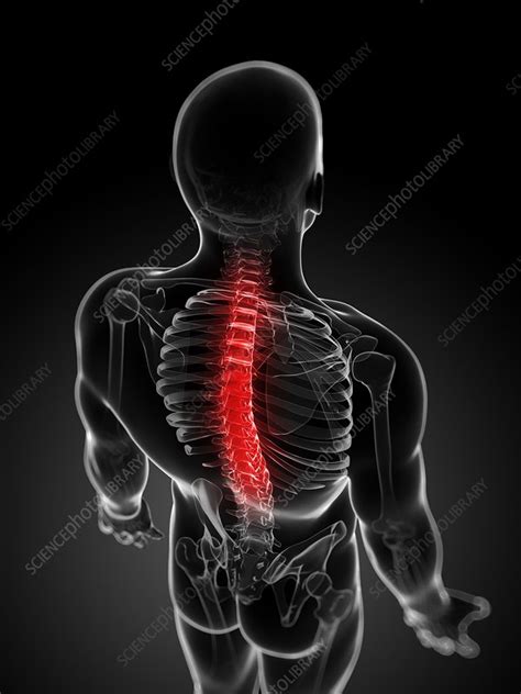 Back Pain Conceptual Artwork Stock Image F0062955 Science Photo
