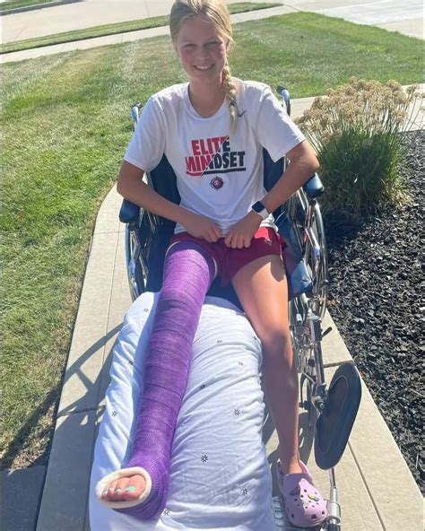beth is out for the season again but seems really happy with big purple cast