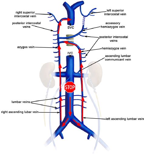 Inferior Vena Cava Anatomy