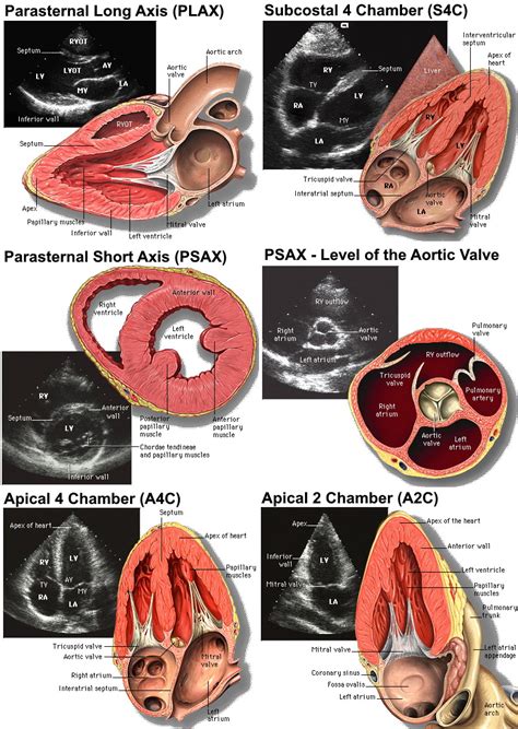 Echocardiogram And Pocus Cardiology Windows And Anatomy Grepmed