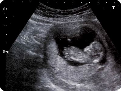 We did not find results for: Pelvic Ultrasound | Pelvic MRI Parsippany NJ