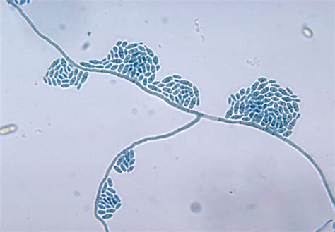 Public Domain Picture | This micrograph reveals the mycelia and conidia of Hortaea werneckii ...