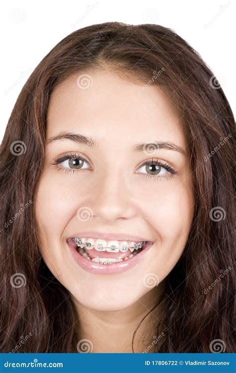 Non Nude Teen Girls With Braces Telegraph