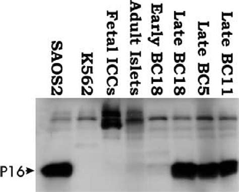 Western Blot Illustrating P16 Expression Levels In Human Pancreatic
